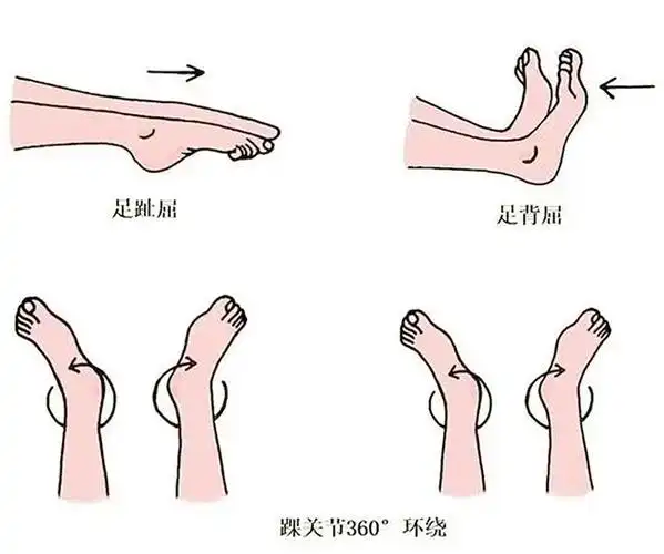 防血栓,"踝泵运动"做起来