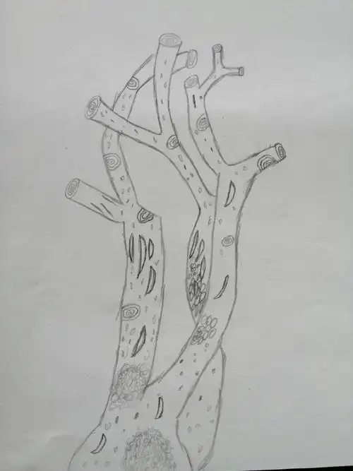 我为树狂～记七年一班,二班树桩写生