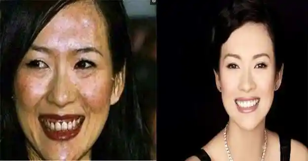 女明星素颜照谁最丑章子怡这脸真是丢脸到国外