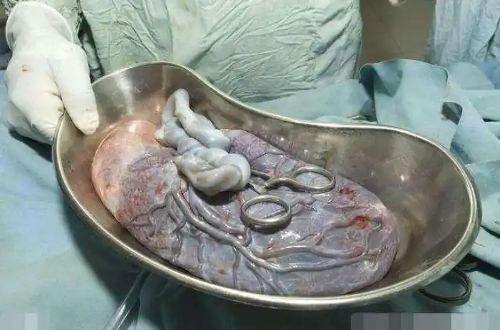 当婴儿在母亲肚子里的时候,需要的很多东西都需要胎盘来