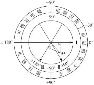 心电图的测量方法_挂云帆