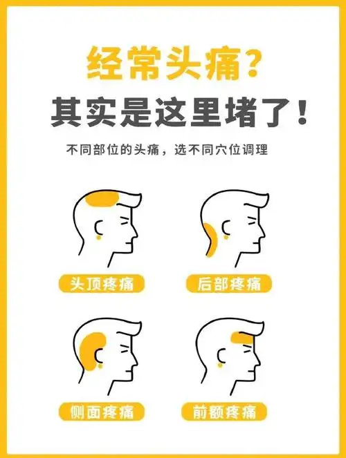 不同部位的头痛选不同穴位调理.