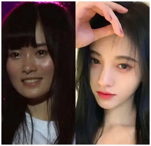 范丞丞周深和童年照一模一样贾玲曾很美鞠婧祎再添整容疑云