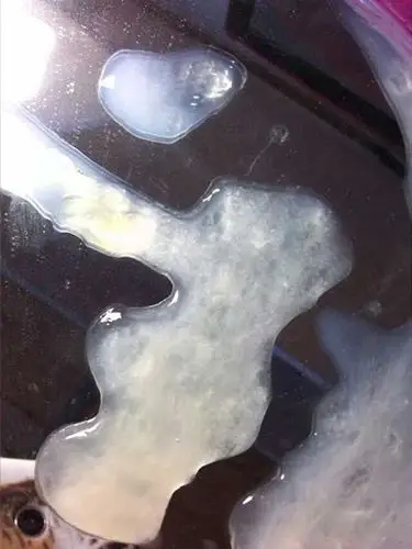 不正常精液液化图片8