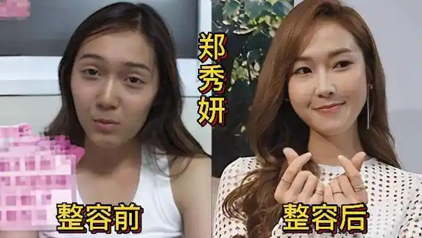 18位韩国女星整容前后对比