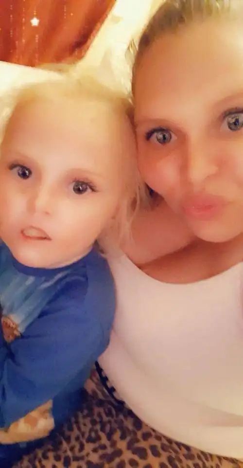 英国有一个可爱的女宝宝,只是从小到大就像瓷娃娃一样,碰不得