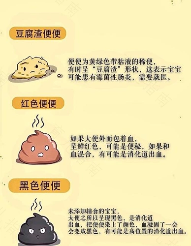 认识宝宝的便便宝宝大便异常认识图