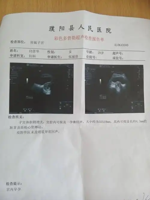 问:此单是怀孕40多天的,问发育正常吗?尤其是胚芽
