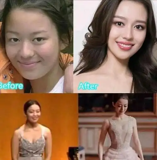 朗朗的妻子吉娜整容前后差距大朗朗看到后都后悔了