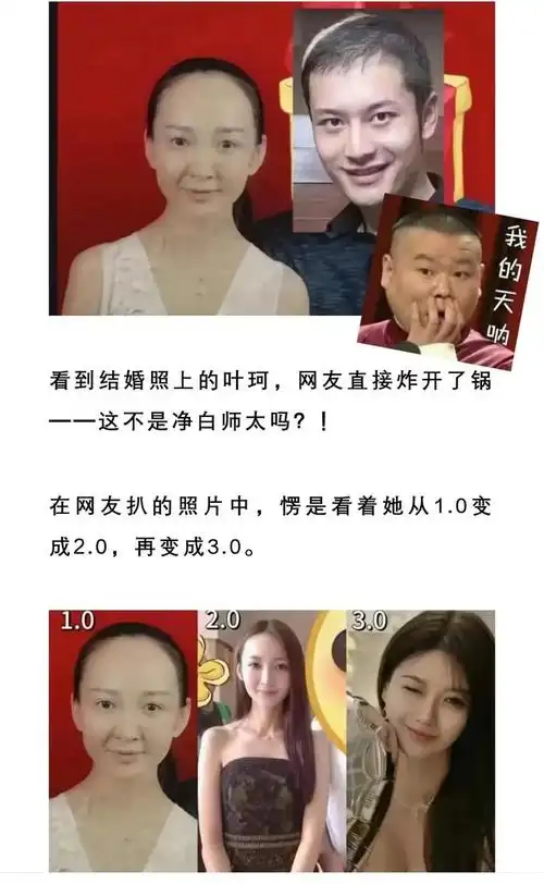 40%叫微do,那么整容是什么?80%吗?她很直率地说自己:微do ,40%.