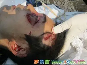 乔任梁自杀原因 乔任梁自杀现场图片 乔任梁死亡原因照片