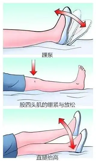 手术前可进行踝泵,直腿抬高,股四头肌的绷紧与放松等练习.