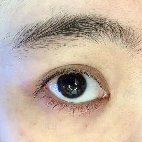 一觉起来眼下张了一颗朱砂痣556