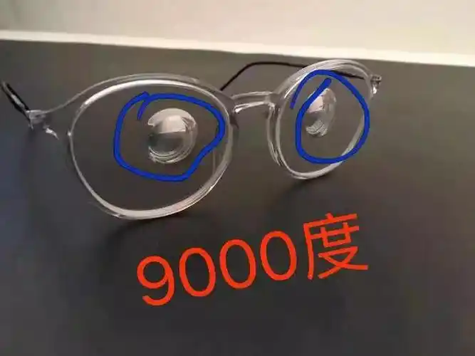 你见过近视8百1千3千5千度你见过9000度吗