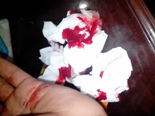 染血是什么意思 染血之手 第四章:准备_900字