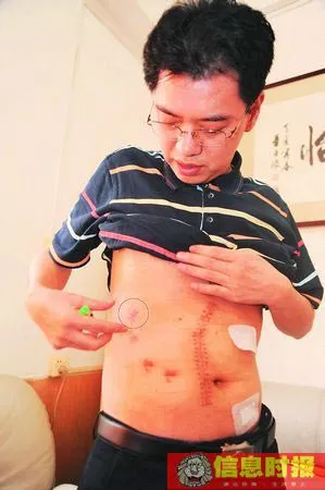 派出所所长中枪后重生 弹头仍在称还能工作(图)