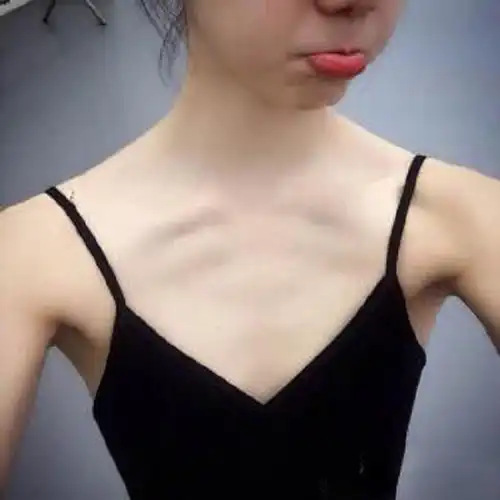 有一种瘦,叫肋骨清晰可见!