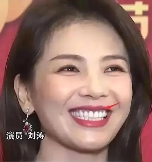 假发假臀假肌肉,大半个娱乐圈"从头假到脚",还有啥是真的?