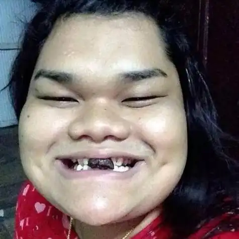 我也和你有相同得问题,我长得还不错,但我男朋友有点丑,当初我