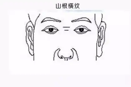 鼻梁有横纹是好还是不好-八字网