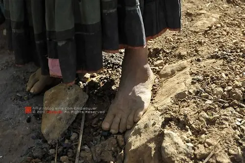 崎岖山路上的那双赤脚.