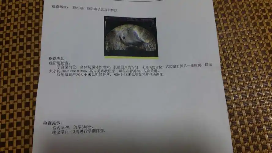 50天孕囊10mm*9mm*10mm会太小么