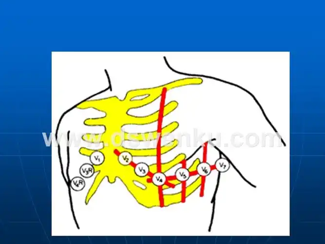 正常范围心电图.ppt