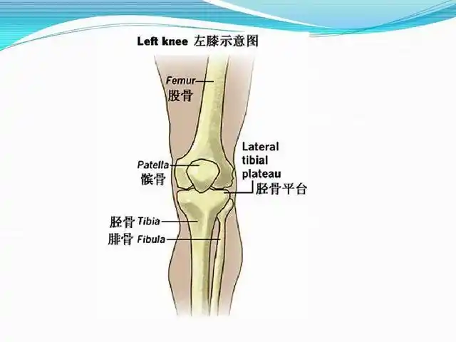 胫骨髁骨折患者临床表现有膝关节疼痛等石膏固定可以防止畸形