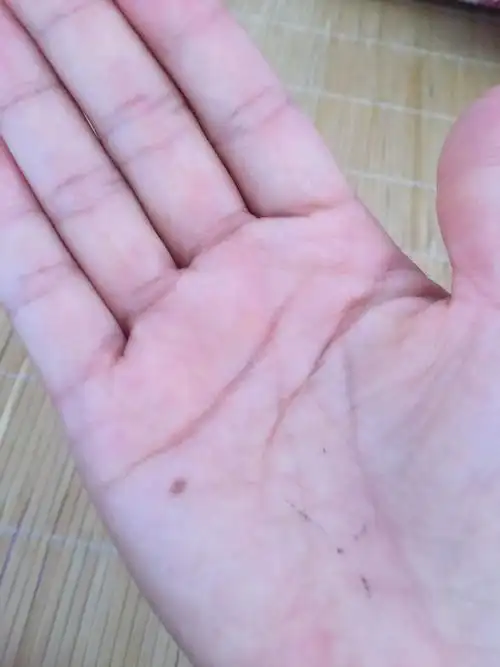 谁能告诉我,我右手手掌的这颗痣代表什么?好吗?我是女生.