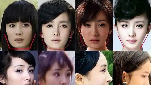 一刀切的"整容脸"明星有变化吗?后遗症已出现,年龄越大越明显