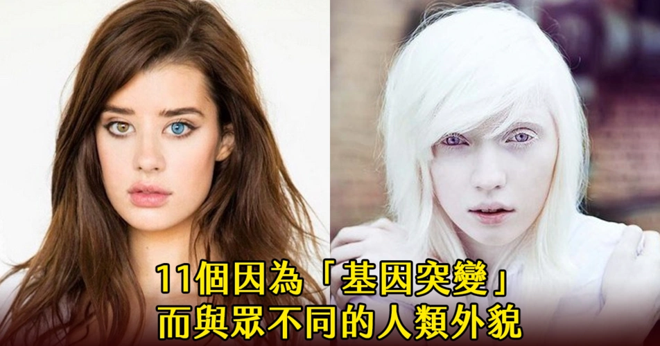 11个被票选为「最美的基因突变」的人类外貌