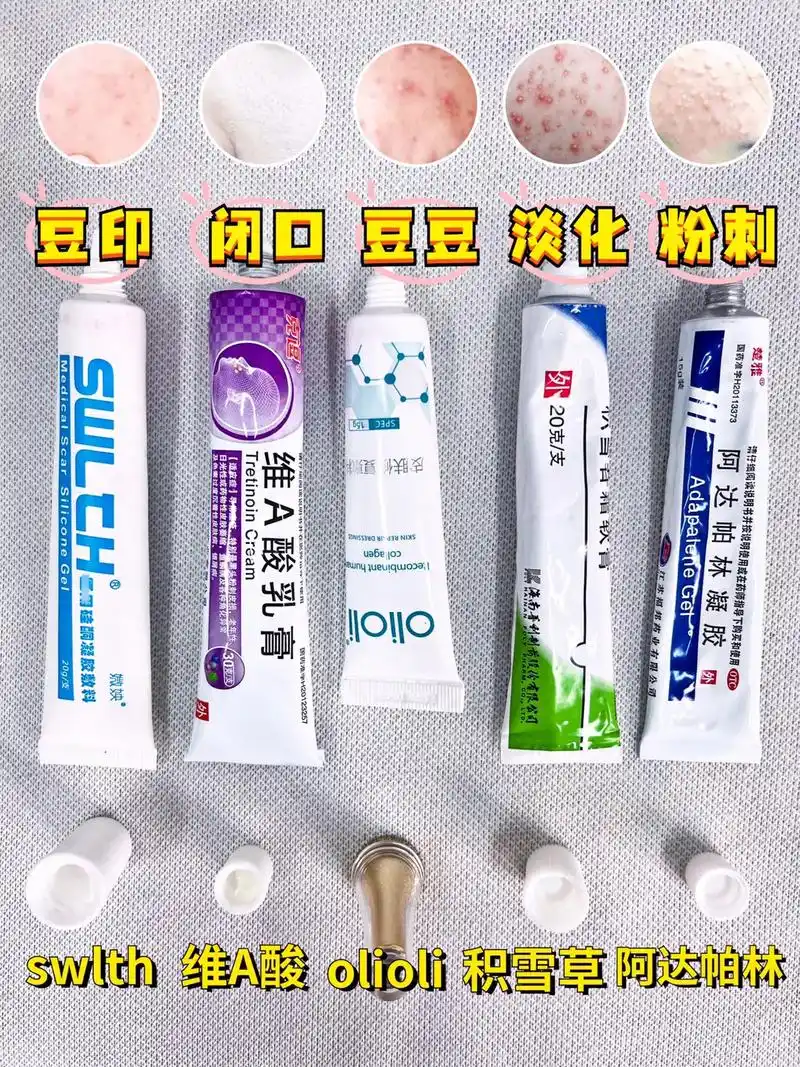 网红祛痘膏在线测评.红祛痘膏在线测评别再瞎跟风啦从初中就开 - 抖音