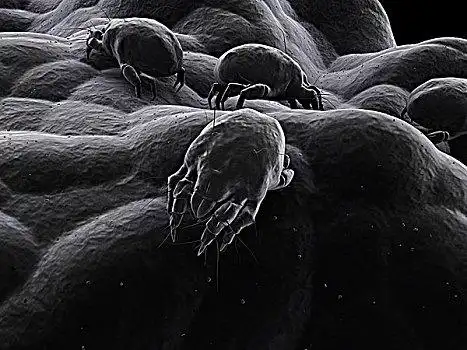 螨虫图片_螨虫图片大全_螨虫图片素材