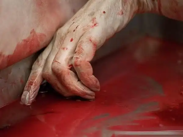 不为人知:摄影师高清镜头下的太平间(组图/慎入)