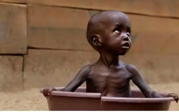 7年前,那个瘦骨嶙峋的3岁非洲小孩,被白人美女收养后过得如何?