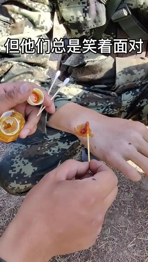 战术训练受伤依然笑着说没事这就是00后新兵安徽武警