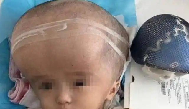 11年后被三鹿奶粉迫害的大头娃娃如今生活怎么样了