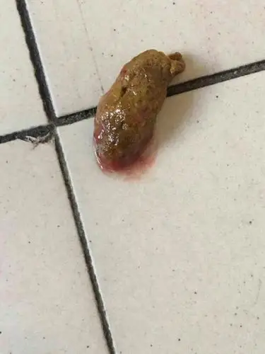 狗拉的血,咋了?