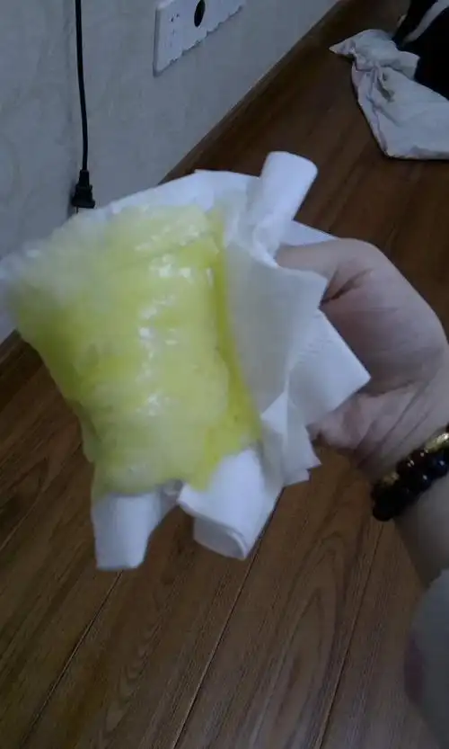 我家边境不肯吃饭,还吐黄色的泡沫状粘稠液体,大便正常,精神正常