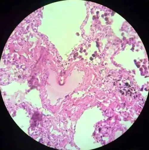 脑洞| 镜下宇宙——医学生的微观花园_切片