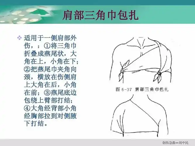外伤急救的四项基本技术