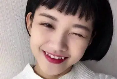 长了虎牙是种怎样的体验?