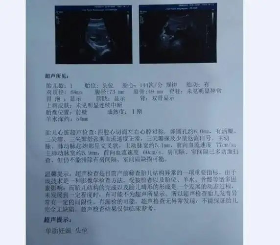 p>胎儿心脏彩超是能够帮助人们了解 a href="#" data-lemmaid="85437