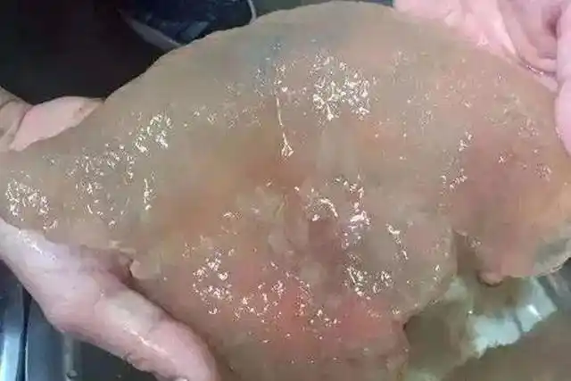 太岁究竟是什么,不属于任何生命形式的"怪肉"?