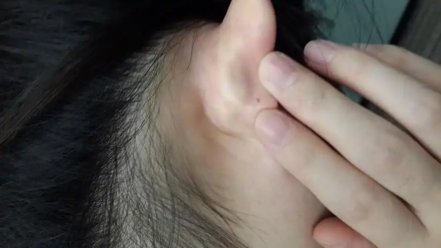 耳朵后面骨头疼连带着头疼