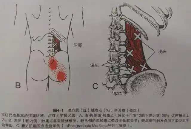 "生而为腰,我很抱歉"|肌肉|肌群|腰椎|关节|方肌_网易订阅