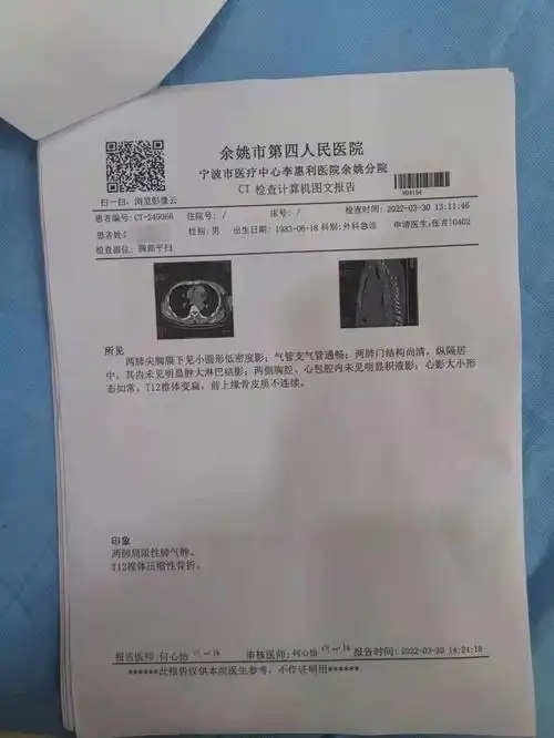 胸12椎体压缩性骨折手术还是保守治疗