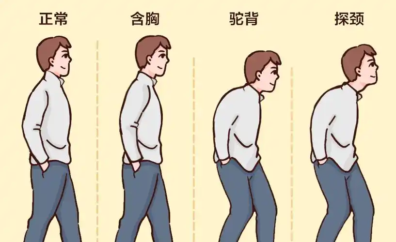 90%的人都可能中招,它的危害比久坐还大_体态