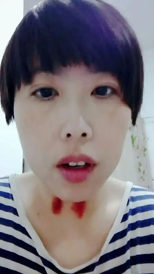 脖子上的红痧,自己用手揪的,最近由于天气干燥,火气比较大,一波流感