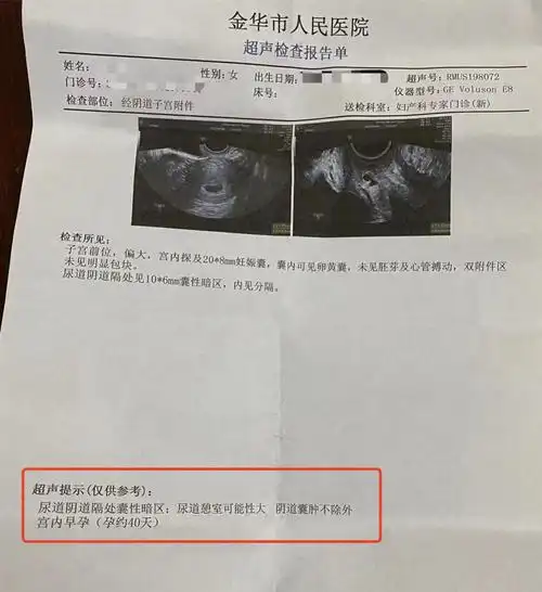 女子称b超未查出怀孕被开禁服药导致打胎,金华妇幼保健院:正协商